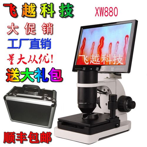 飞越高环880微型甲襞循手清指末梢血管K观察仪血流速检测仪显微镜