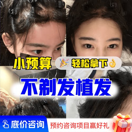 【植发咨询】雍禾不剃发植发 主任团队预约 获取方案详情+报价