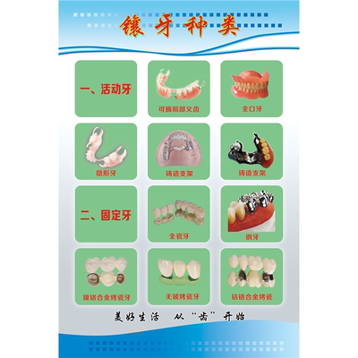 镶牙种类海报贴纸贴画牙科广告牙科宣传画口腔科墙面自粘装饰画