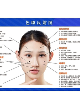 色斑反射图海报展板面部色斑与痤疮的产生分析图墙贴纸KT板墙纸