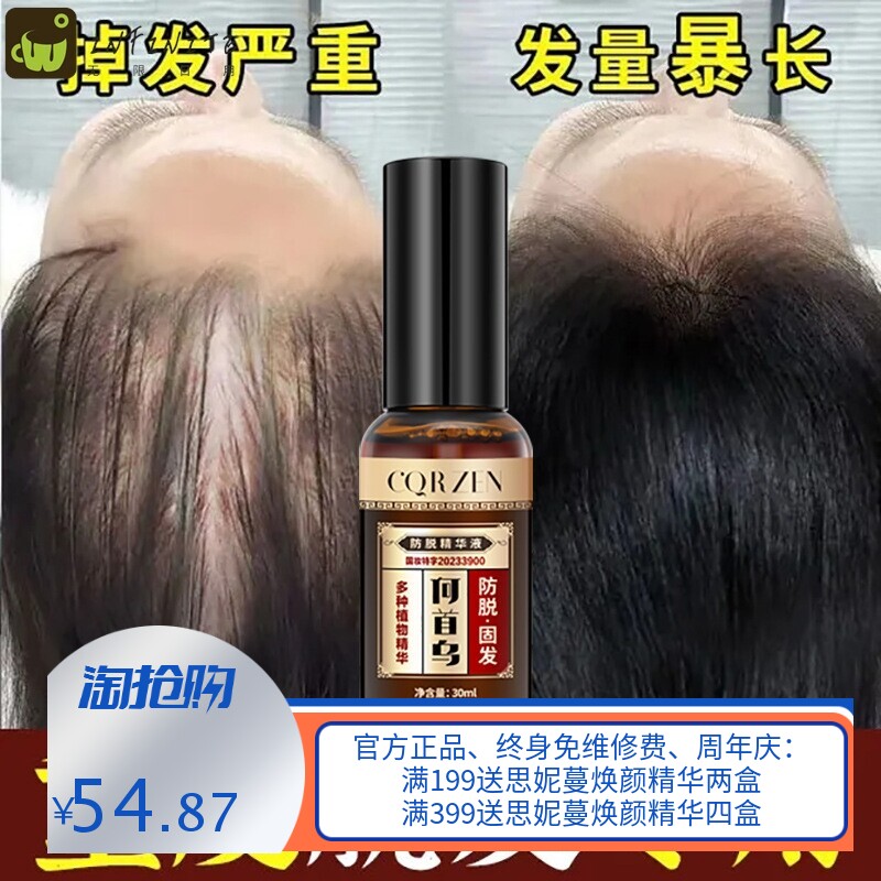 CQRZEN防脱精华液增发发际线稀少发固发男女老人养发浓密发根救星