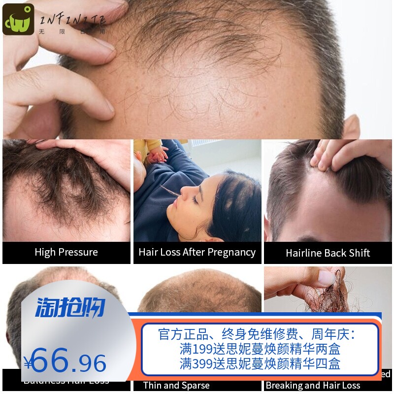跨境滋生头发护理按摩精油生姜密发防脱精华液头皮干燥起皮精油