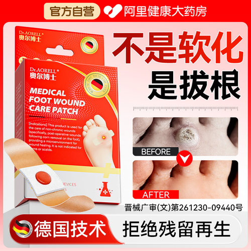 德国医用级鸡眼贴膏拔脚钉除膏鸡茧眼去跖疣根肉刺扁平疣专用神器
