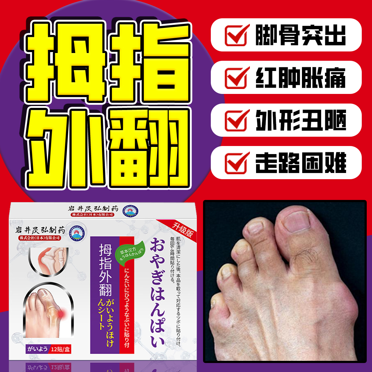 日本特效拇指外翻矫正神器大脚骨关节畸形脚趾突出疼痛专用药膏贴