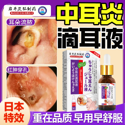日本特效滴耳液耳朵发痒药膏止痒耳道消炎专用硼酸冰片中耳氟康唑