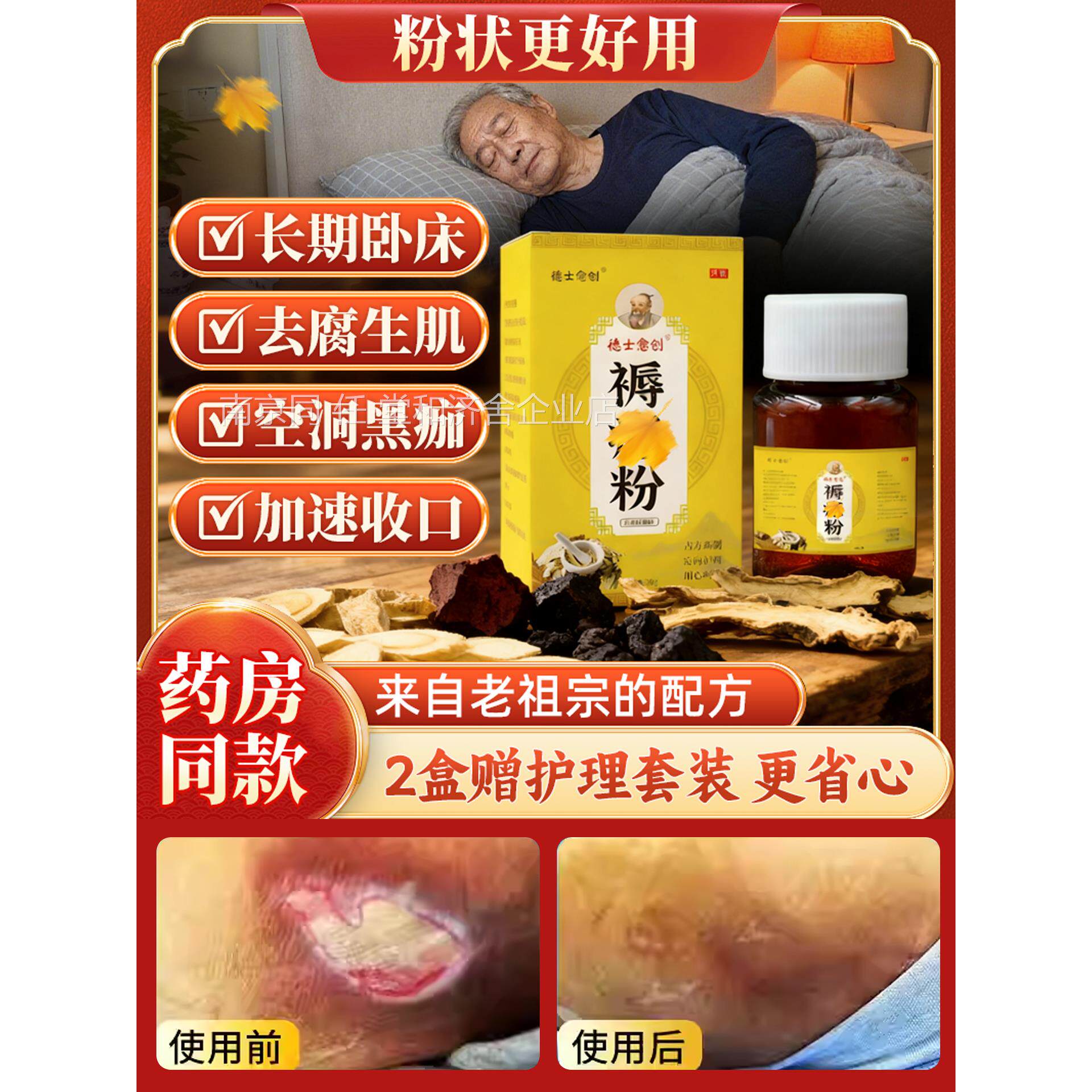 散粉褥疮膏老人部外用防压疮药屁股烂专用卧床瘫痪护理用品大臀全