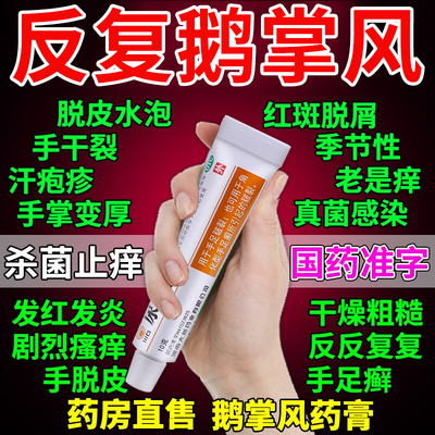 鹅掌风专用手癣膏药脱皮干裂真菌感染烂手杀菌止痒尿素乳膏正品