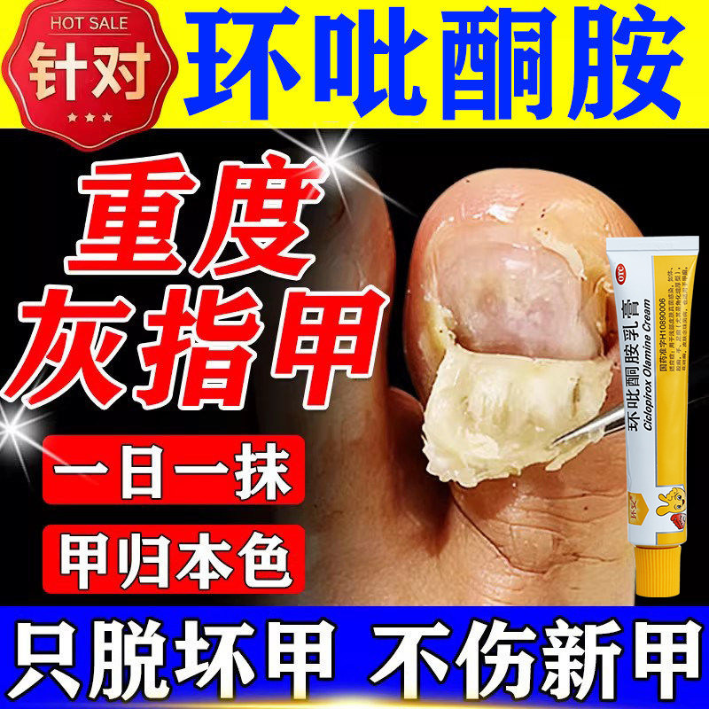 [环安]环吡酮胺乳膏1%*15g*1支/盒