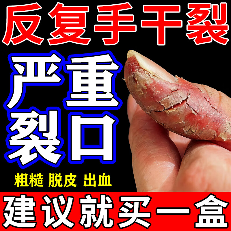 治手足皲裂也可用于角化型手足癣引起的皲裂