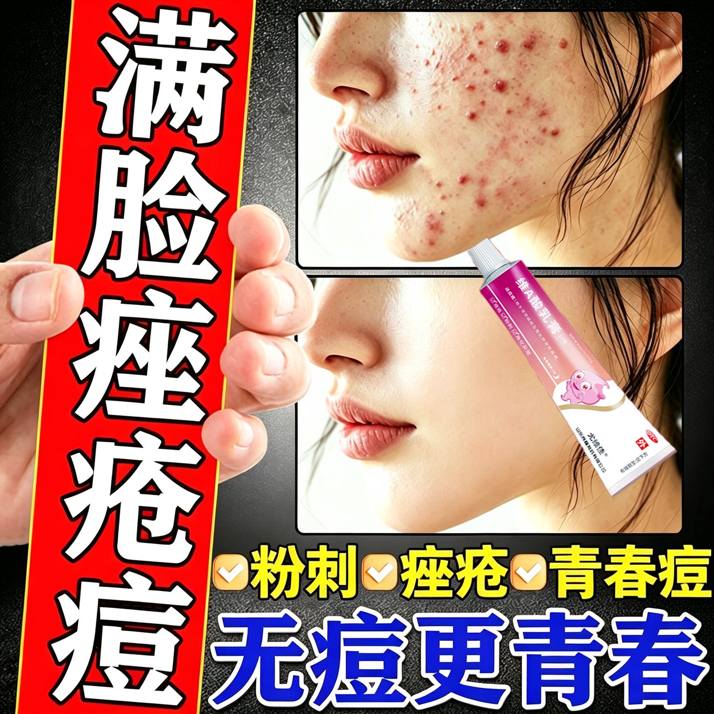 [良福]维A酸乳膏0.1%*15g*1支/盒