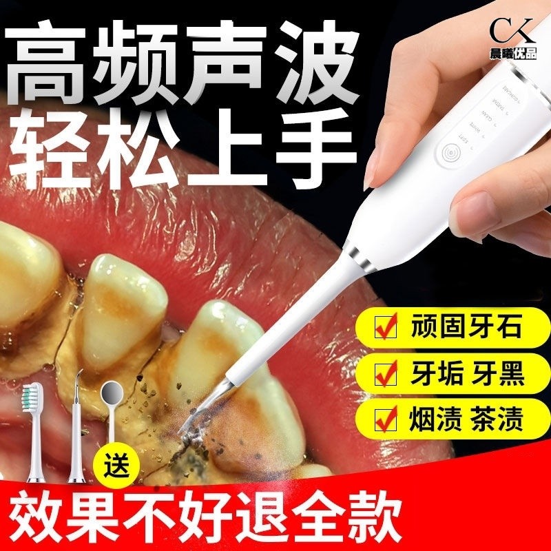 掏剔抠牙结石神器l扣牙石清理刮牙垢器清除工具去除器头专业声波