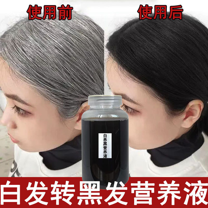 何首乌白发转黑发精华液养发密发乌黑乌发液黑发营养液毛囊养护乳