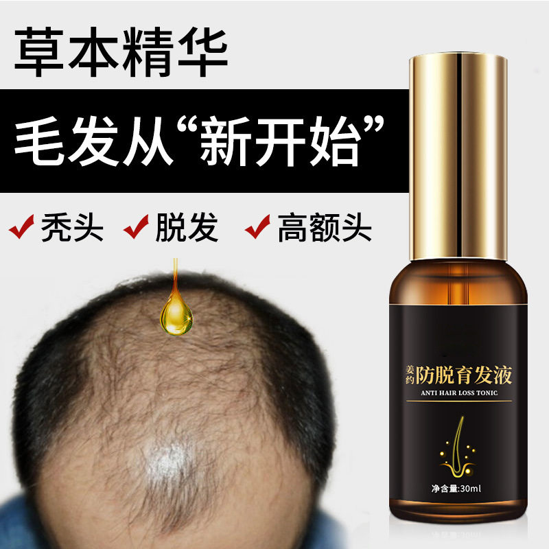 姜约防脱育发液产后脱发稀少增密养发头发精华液厂家直供育发液