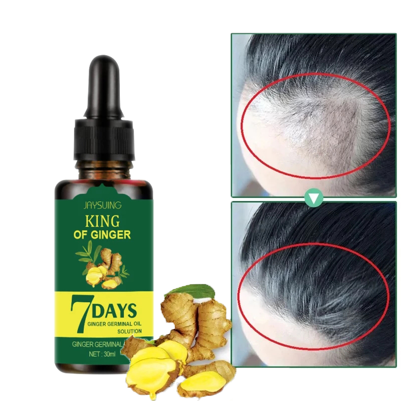 Hair Loss Treatment Ginger Growth Essence Oil老姜头发营养液