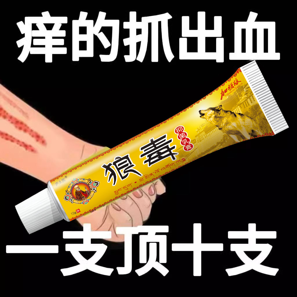 狼毒王快速止痒皮肤干燥瘙痒外用全身干痒止痒膏皮肤瘙痒真菌正品
