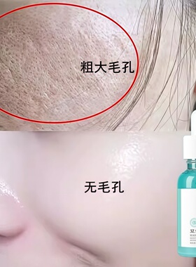 【屈臣氏热卖】毛孔不见了