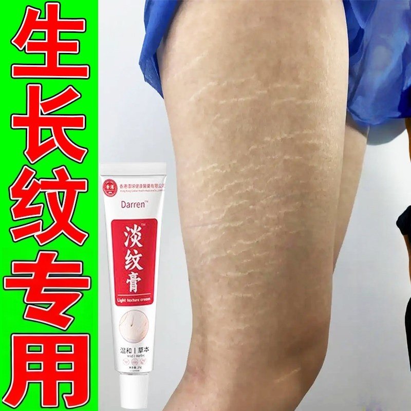 去肥胖纹修复霜生长纹消除学生大腿生长纹淡化妊娠纹屁股紧致膏