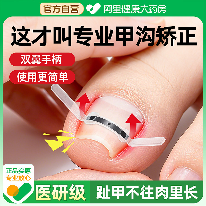 【皮肤科推荐】甲沟嵌甲矫正器