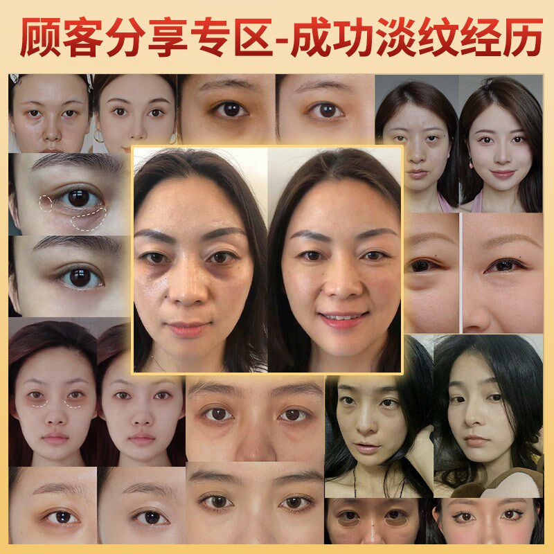 工厂)玻色因菁纯眼霜平替 w抗皱紧致淡眼袋黑眼圈眼部精华 护肤品