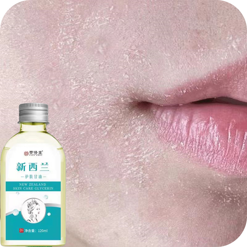 脸上起皮起皮掉皮干皮脸起皮发痒嘴边干燥起皮干皮脸部干燥脸干痒