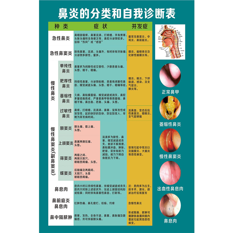 鼻炎的分类和自我诊断表海报展板各种类型鼻炎鉴别表墙贴墙纸KT板,个性定制/设计服务/DIY,写真/海报印制,淘宝优惠券,粉丝福利购,淘宝优惠卷