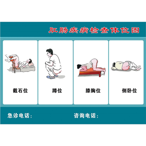 肛肠疾病检查体位图海报展板墙贴墙纸装饰画KT板
