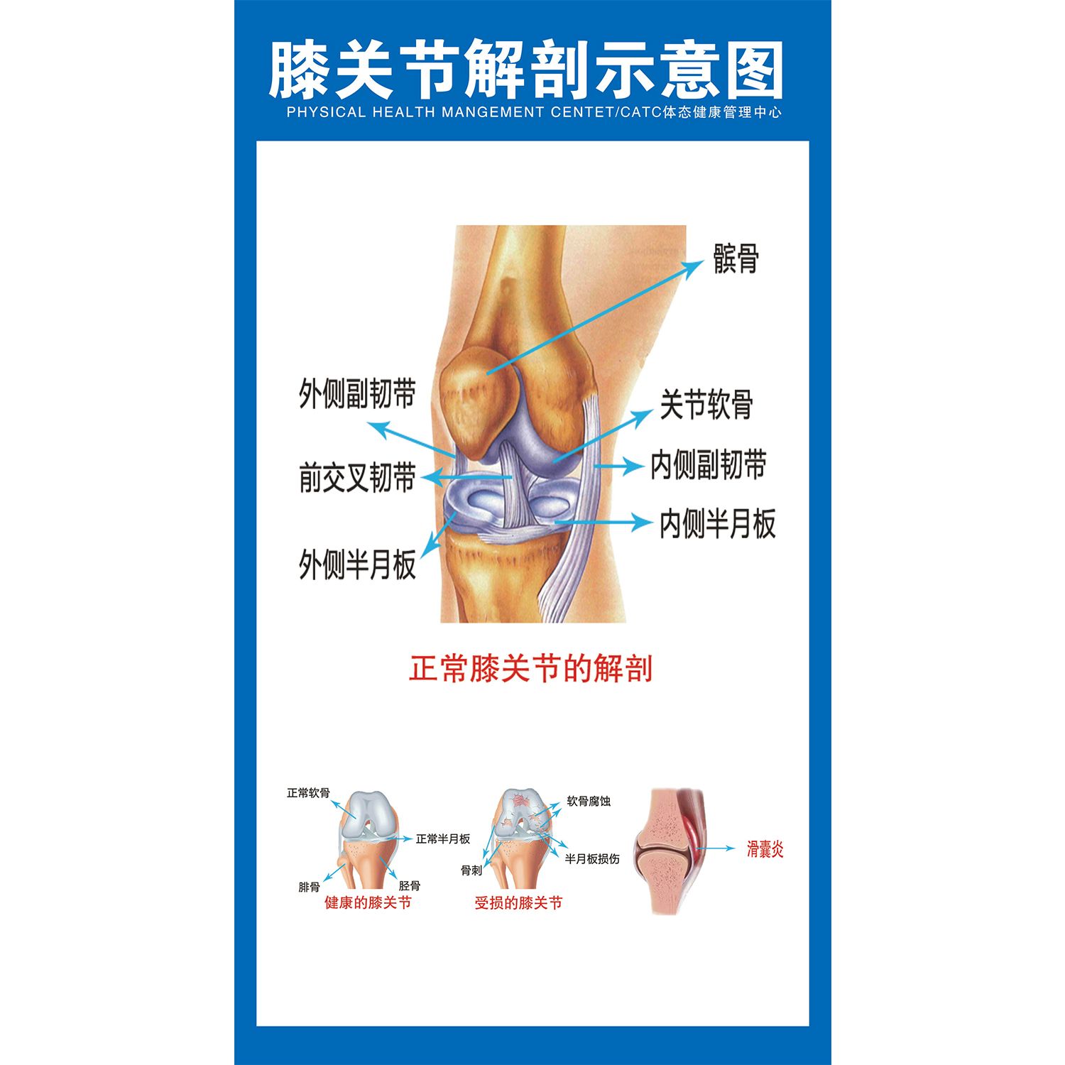 中医养生馆美容院膝关节痛的症状挂画挂图海报膝关节解刨示意图