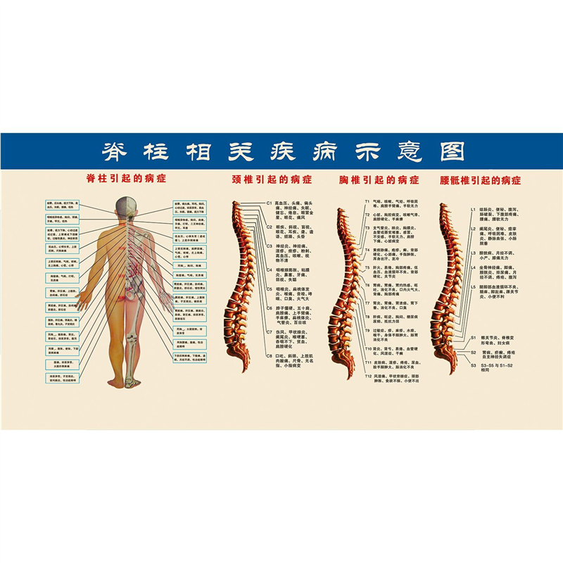 中医养生脊椎相关示意图中医馆脊椎腰椎疾病装饰画海报理疗馆挂图