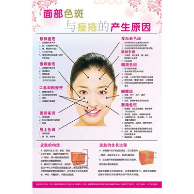 面部色斑和痤疮的产生原因分析海报宣传画广告贴图片挂画图