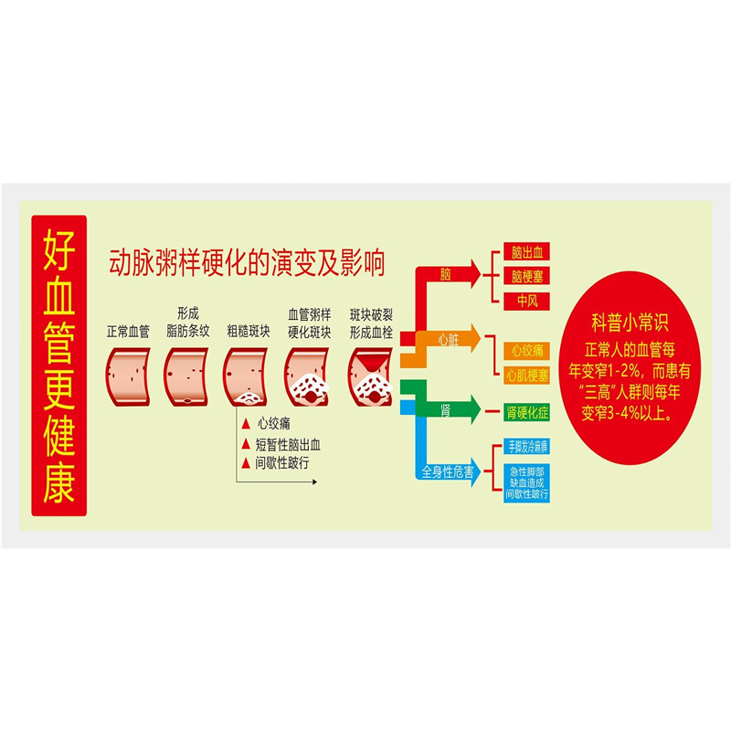 动脉粥样硬化的演变及影响  好血管更健康宣传画自粘贴画