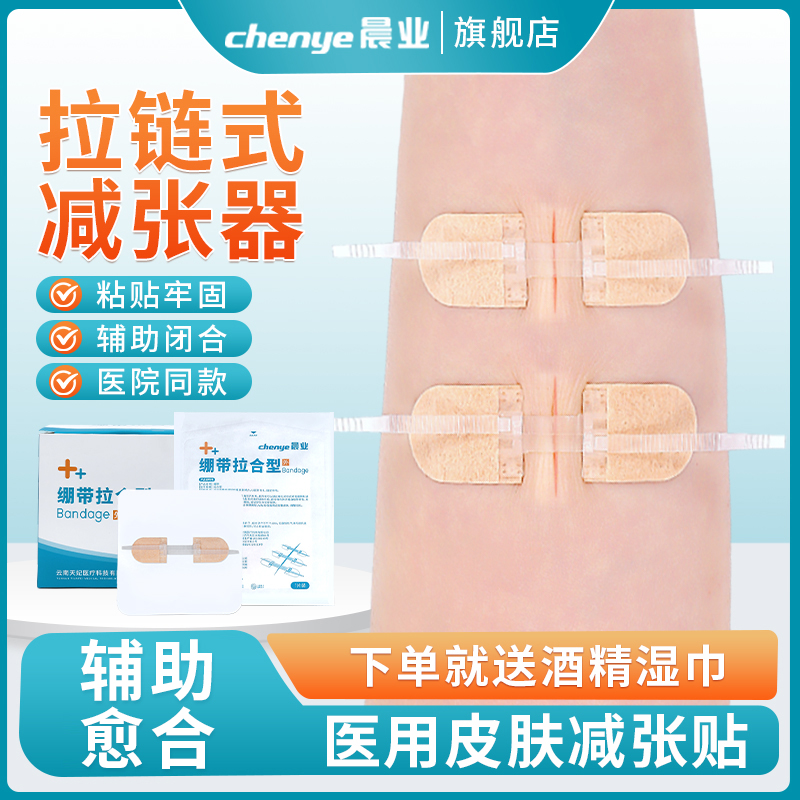 晨业医用皮肤减张贴免缝合小伤口