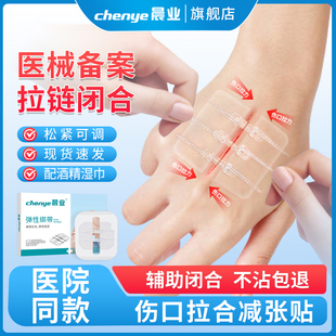 皮肤减张器伤口医用辅助愈合手术剖腹产儿童术后拉链伤口贴减张贴