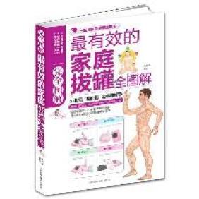 正版的家庭拔罐图解