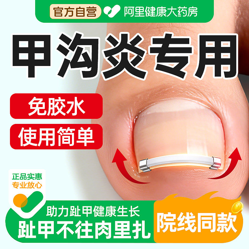 正甲扣甲沟嵌甲矫正器脚趾甲往肉里长专用炎纠正卷甲指甲扎肉神器