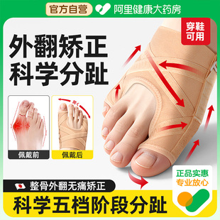 拇指外翻小趾内翻脚趾矫正器脚趾头分离纠正分趾器大脚骨可穿鞋
