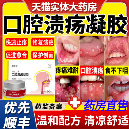 鹿思达口腔溃疡凝胶正品
