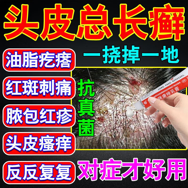 头癣药膏治头皮癣头部红斑瘙痒真菌感染结痂屑硝酸咪康唑乳膏正品