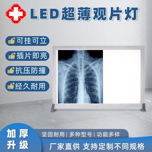 爆款厂家现货单双联LED观片灯片X光胶片观片灯超薄阅片灯CT看片灯