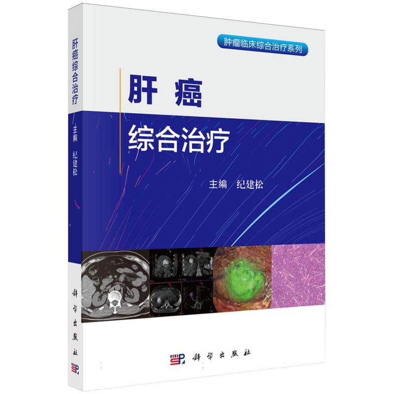 肝癌综合治疗/肿瘤临床综合治疗系列