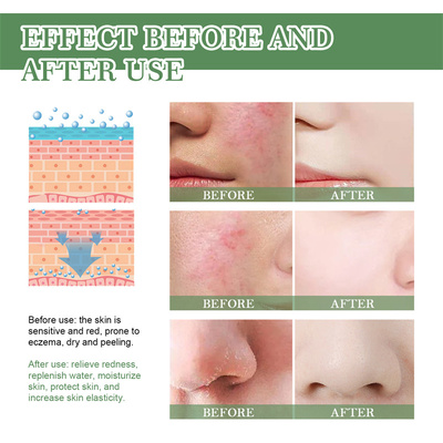 极速Repara??o facial vermelhAid?o multi bounce blsamo v