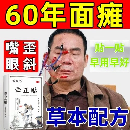 面瘫特效药膏贴后遗症恢复脸部僵硬嘴歪麻木训练器牵正热敷贴神器