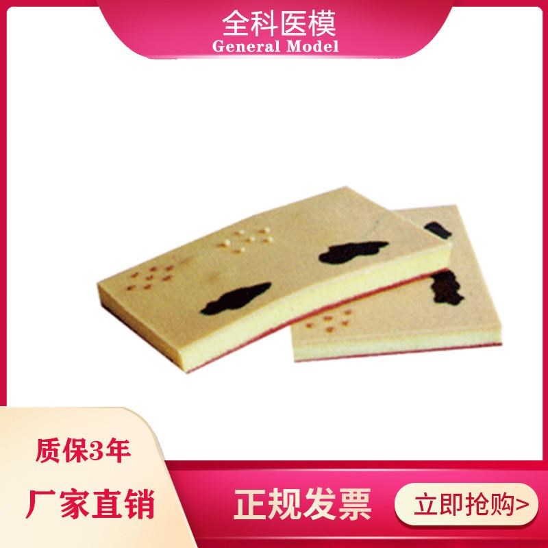 表皮常见b病表处理训练模块GMS/W00103