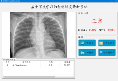 DL00349-基于深度学习的智能肺炎诊断系统代码数据集可部署