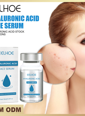 Hyaluronic acid essence gently cares, lightens facial acne m