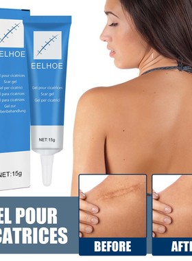 Scar Repair Gel Repairing Softening Smoothing Scars Moisturi