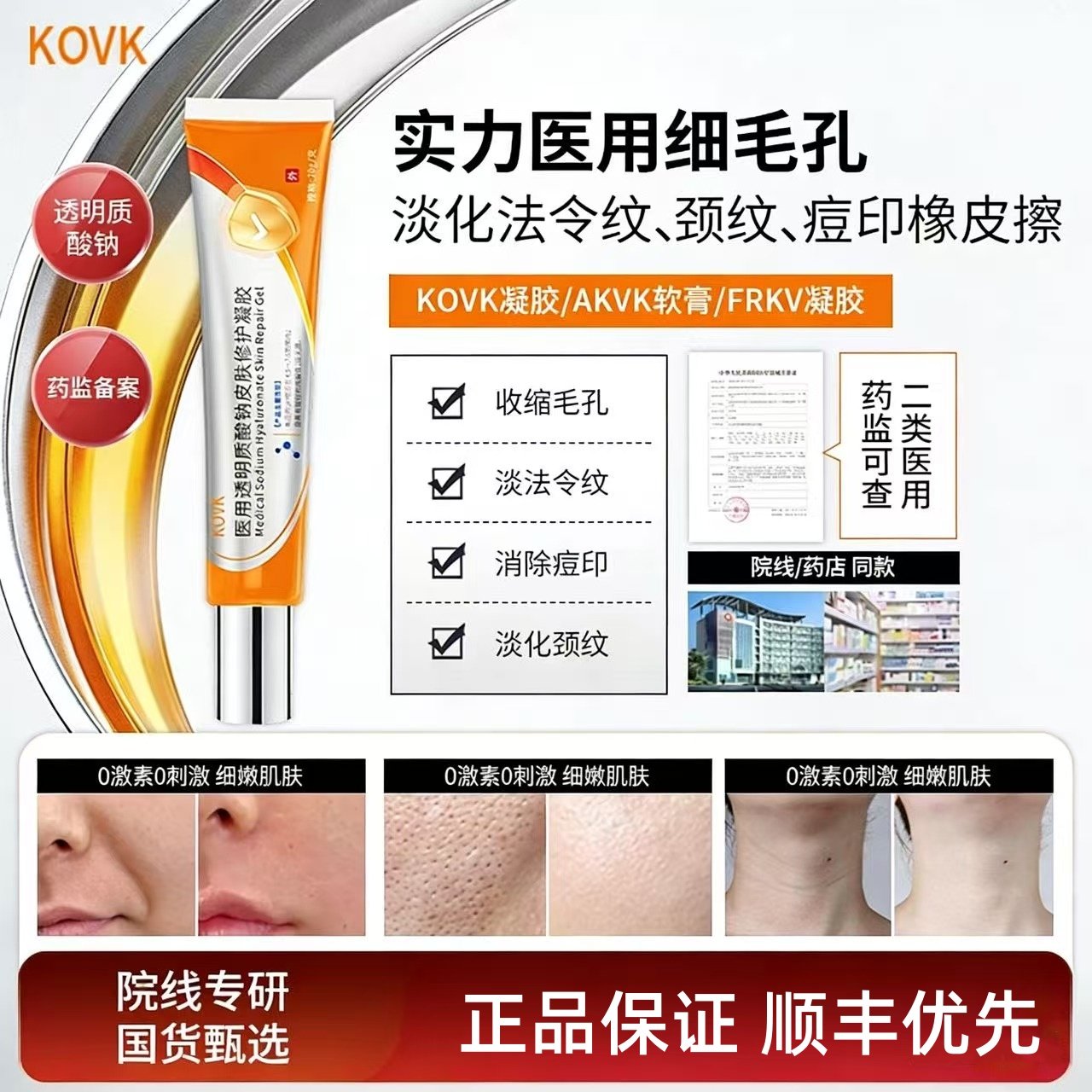 KOVK凝胶AKVK软膏透明质酸钠FRKV凝胶细致毛孔痘印闭口淡溢脂性,医疗器械,保健理疗,淘宝优惠券,粉丝福利购,淘宝优惠卷