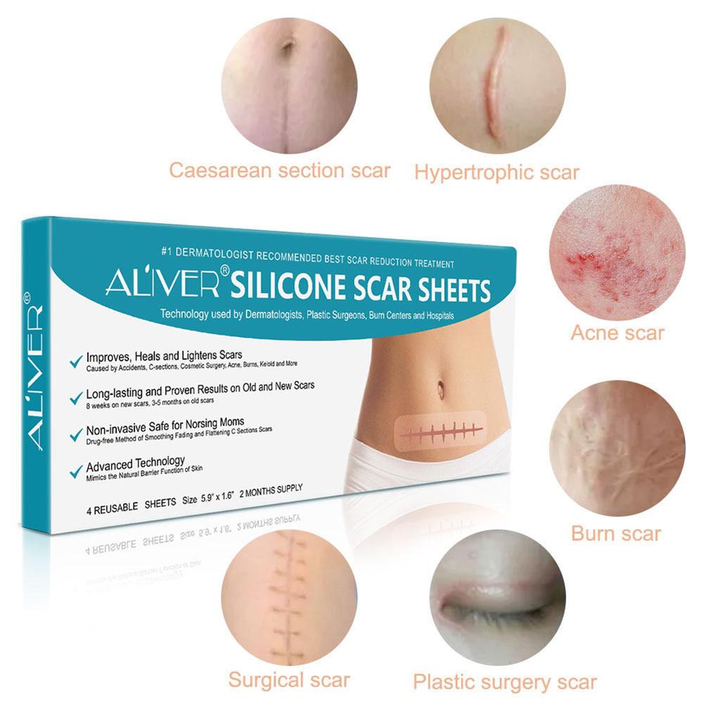 速发4pcs/box Reusable Silicone Scar Removal Patch Remove Tra