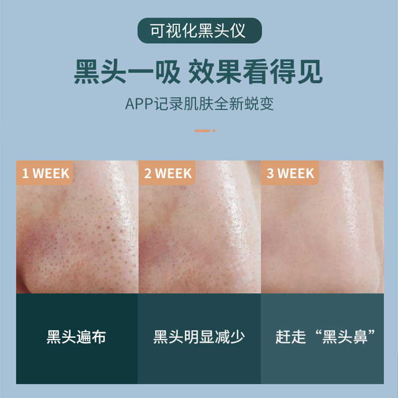 极速可视化吸黑头神器家用电动祛粉E刺吸出器面部毛孔清洁小气泡