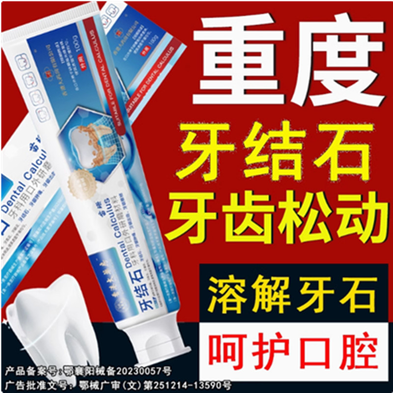 【香港大药房】牙结石去除器溶解专用洗牙齿污垢牙石牙渍牙垢黄牙