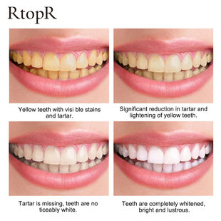 Oral Stains Cleansing TeethR whitening cleaning 极速Teeth